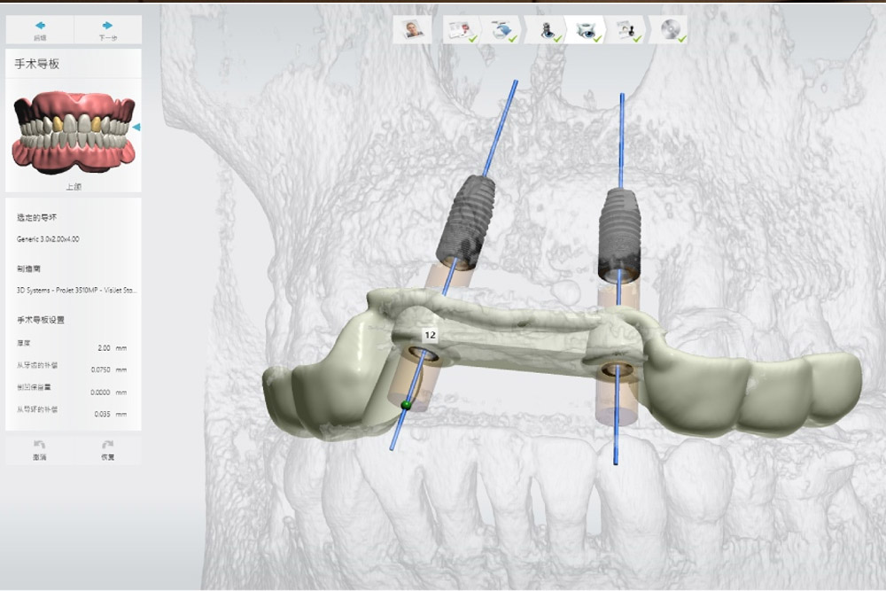 周煥珵醫師《我的植牙為何不成功？ 牙醫師揭露傳統植牙失敗最大主因》